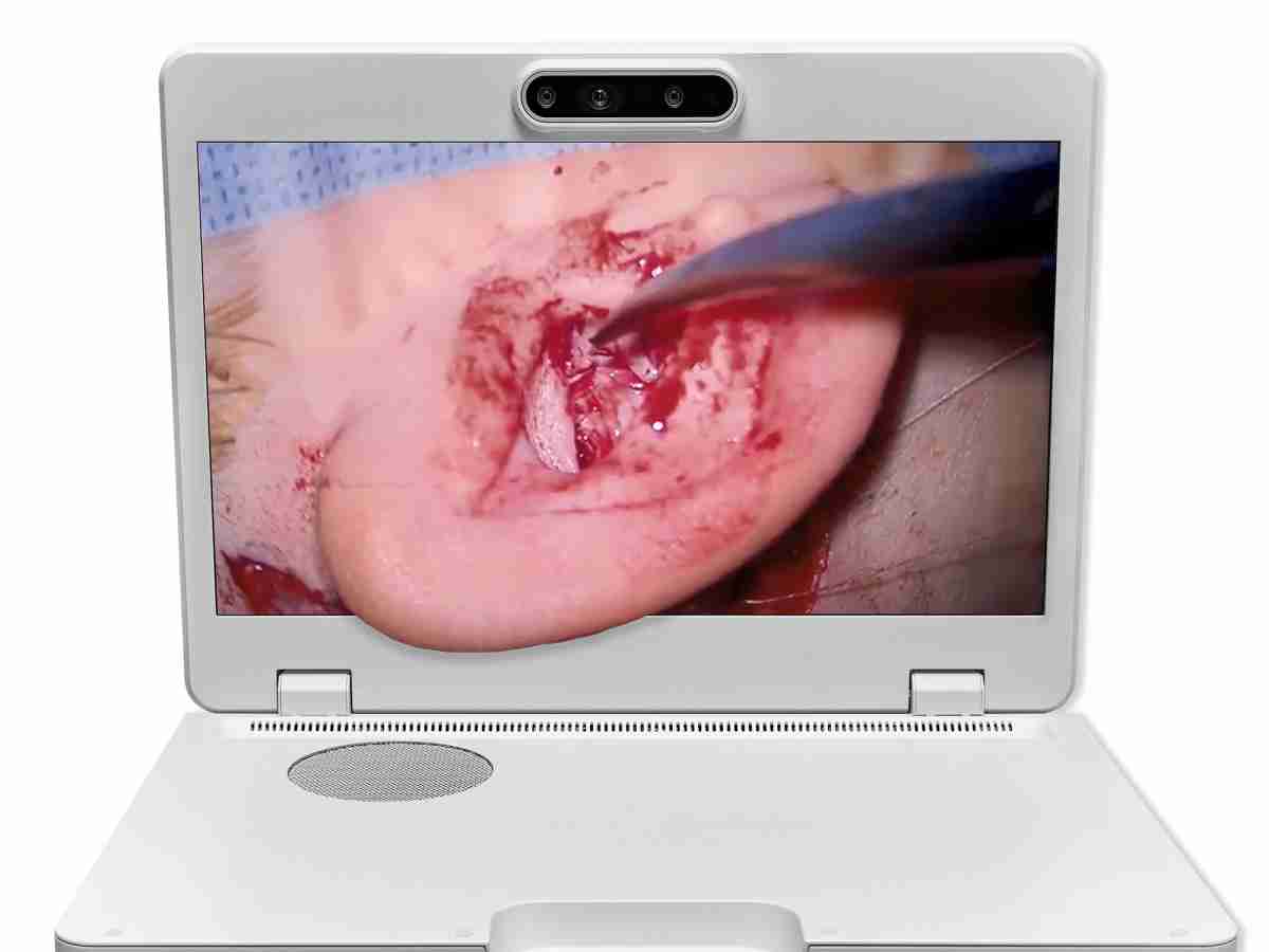 达擎之＂Heads-up 3D显微手术显示系统＂，，整合4K裸眼3D显示及眼球追踪系统，，具备快速追踪人眼移动位置功能，，减轻医师长时间维持固定姿势的负担，，让医师能有更宽广清晰的3D立体视野及更舒适的姿势来执行手术。。。